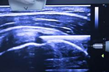 ultrasound